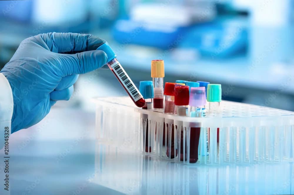 Routin Lab tests